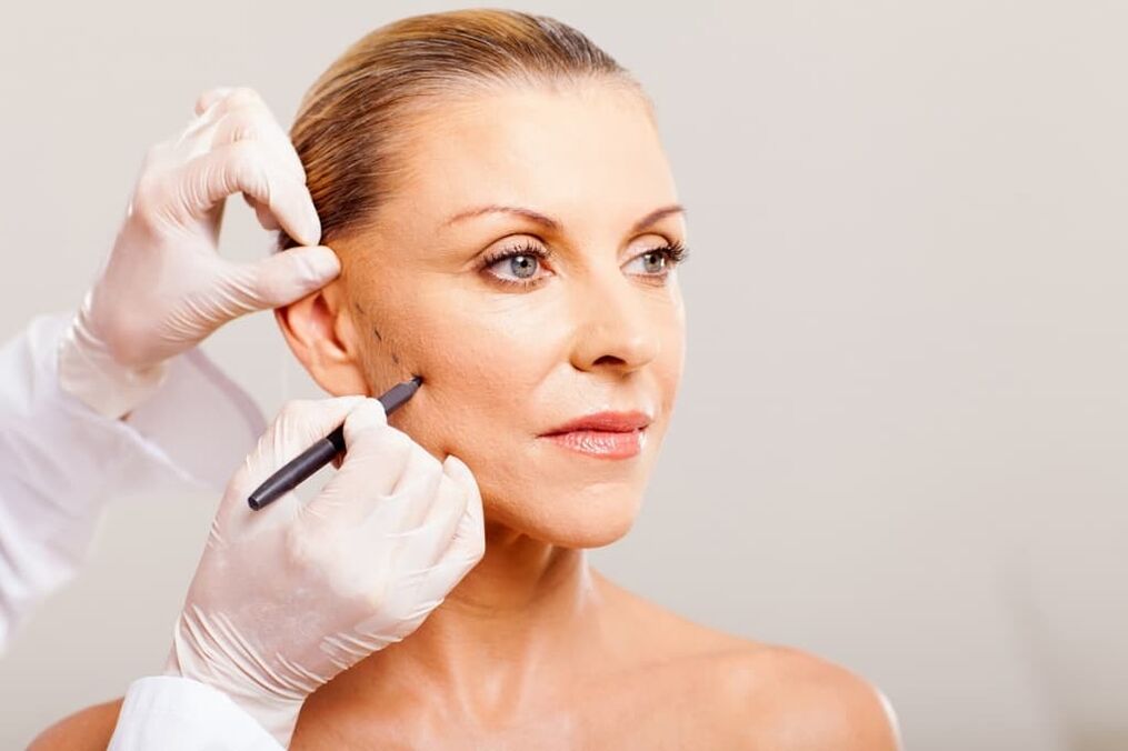 felkészülés az arcplasztikai műtétre a fiatalítás érdekében